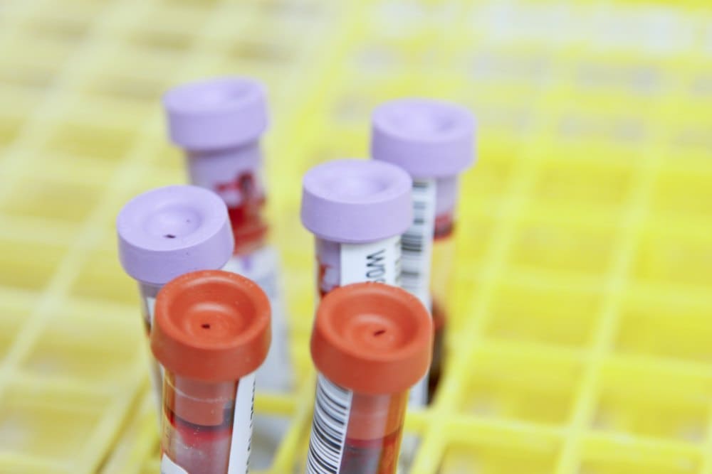 Labelled sample tubes in a rack ready for testing
